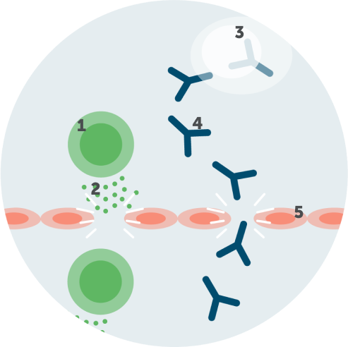 Depiction of the two ways that IgG autoantibodies have been shown to contribute to disease progress in CIDP. Depiction of the two ways that IgG autoantibodies have been shown to contribute to disease progress in CIDP.